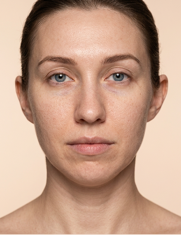 Before - Jessica L.